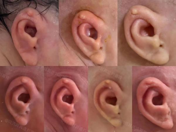 一个耳朵两个洞（一个耳朵两个洞,上面戴金,下面戴银可以不）