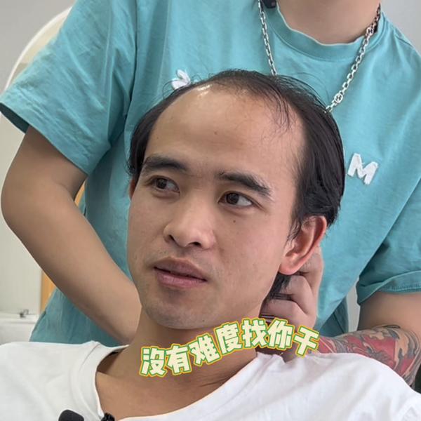 拯救秃头人士的发型.大哥你这个也太有难度了.没有难度找你干.