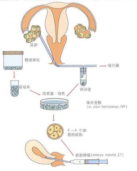 试管婴儿短方案流程(短方案一般取卵几个)