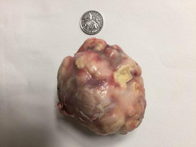 "鸡宝",药用价值很大,可能价值不菲.