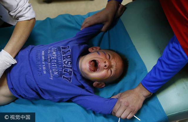 或者是出生之后几割礼就是割去男孩阴茎上过长的包皮,是信仰