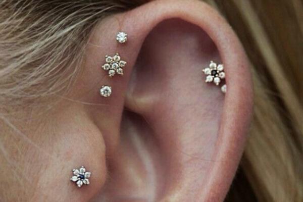 激光打耳洞多少钱(医院激光打耳洞多少钱)