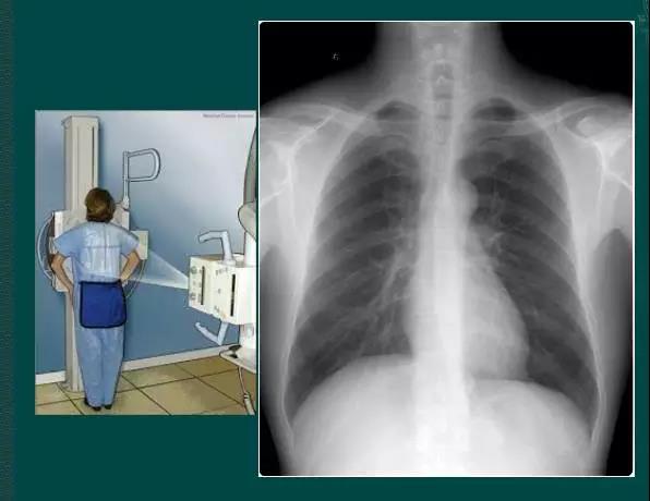 胸透流程学生胸透流程