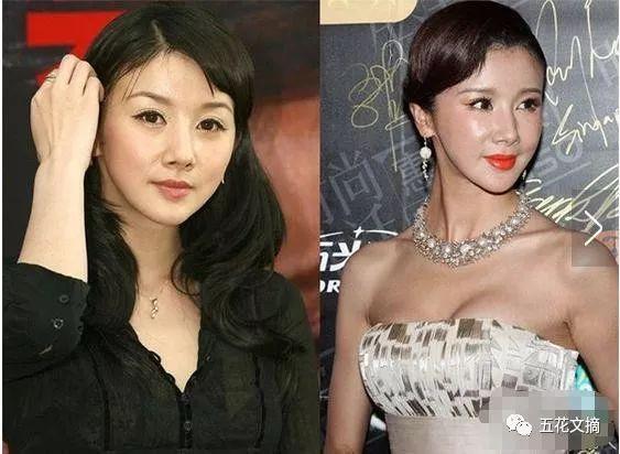 7大女明星整容失败越变越丑 萧蔷脸肿嘴歪 巩新亮成“僵尸新娘”