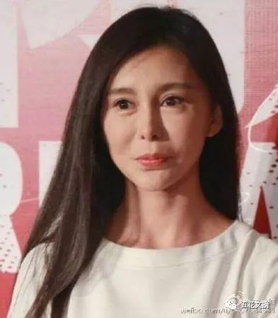 7大女明星整容失败越变越丑 萧蔷脸肿嘴歪 巩新亮成“僵尸新娘”