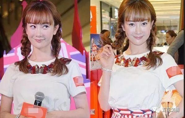 7大女明星整容失败越变越丑 萧蔷脸肿嘴歪 巩新亮成“僵尸新娘”