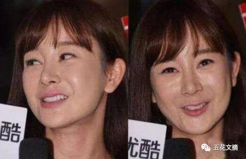 7大女明星整容失败越变越丑 萧蔷脸肿嘴歪 巩新亮成“僵尸新娘”