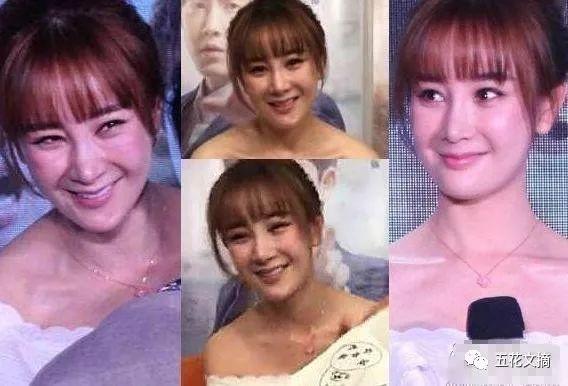 7大女明星整容失败越变越丑 萧蔷脸肿嘴歪 巩新亮成“僵尸新娘”
