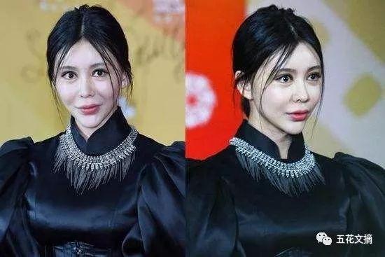 7大女明星整容失败越变越丑 萧蔷脸肿嘴歪 巩新亮成“僵尸新娘”