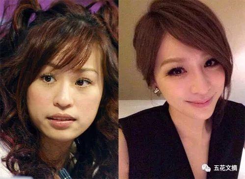 7大女明星整容失败越变越丑 萧蔷脸肿嘴歪 巩新亮成“僵尸新娘”
