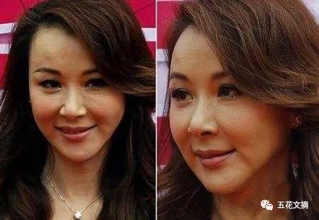 7大女明星整容失败越变越丑 萧蔷脸肿嘴歪 巩新亮成“僵尸新娘”