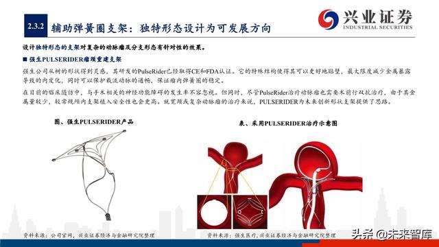 神经介入器械投资策略：百亿市场尚处起步期，国产替代潜力巨大