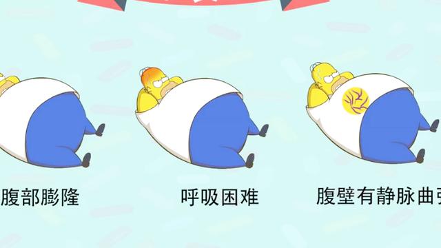 腹水什么意思肚子腹水有什么症状