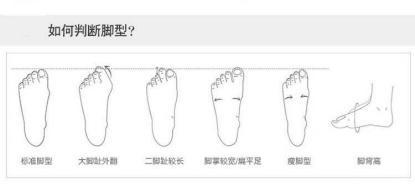 寒冬来临，高脚背、扁平足、足跟痛、拇外翻如何挑选合适的鞋