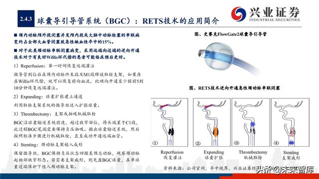 神经介入器械投资策略：百亿市场尚处起步期，国产替代潜力巨大