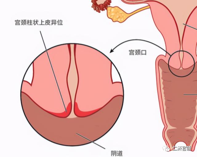 如何应对广州妇科炎症：最新行业动态解读
