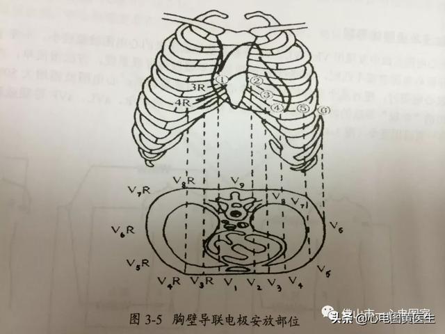 心電圖的操作流程(心電圖導聯位置)