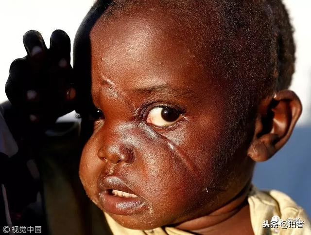 路透社公布2018年度图片，INS上点赞最多的照片有哪些？