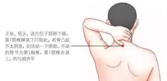 “富贵包”并非富贵之相，提示你的身体可能出了状况