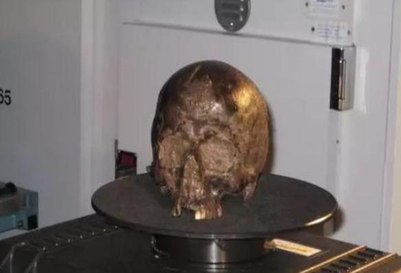 2600年前的大脑，似乎还“活着”，科学家：死者生前遭到残忍酷刑