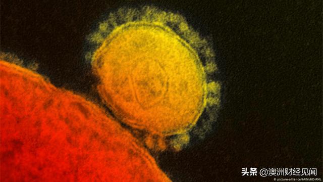 澳洲科学家发明“消毒涂层”，声称1小时内可杀灭新冠病毒！