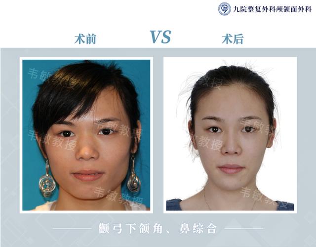 958a2e2b7eb3408486c342e6241f3a6d?from=pc