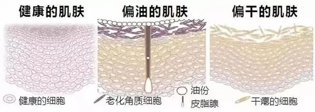 震惊！皮肤科门诊爆号了：空调下皮肤伤不起，水和油都离家出走了
