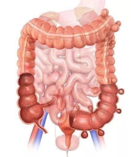 憩室什么意思(子宫憩室是什么意思)