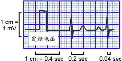 心電圖的操作流程(心電圖導聯位置)