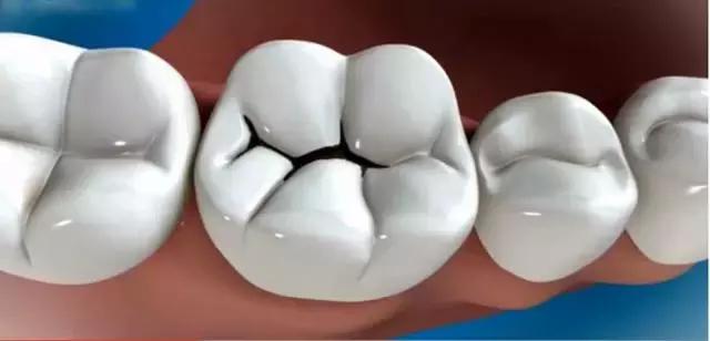 牙科流程(牙科器械消毒流程)