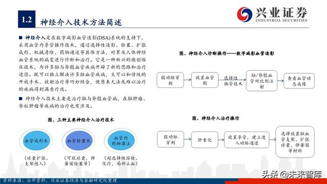 神经介入器械投资策略：百亿市场尚处起步期，国产替代潜力巨大
