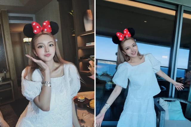 周扬青罕见晒照露额头，被问“什么整形医院整