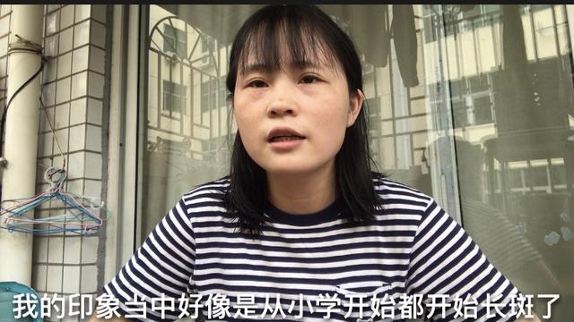 做激光祛斑要多少钱(激光去斑后我后悔了)