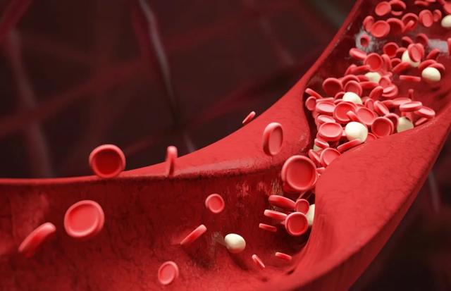 A Clogged Blood Vessel Will Be Riddled With All Kinds Of Diseases Be Careful With These Things 