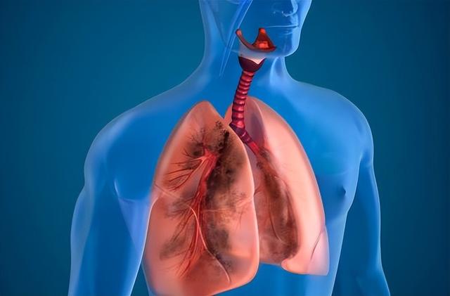 about-700-000-people-suffer-from-lung-cancer-every-year-can-lung