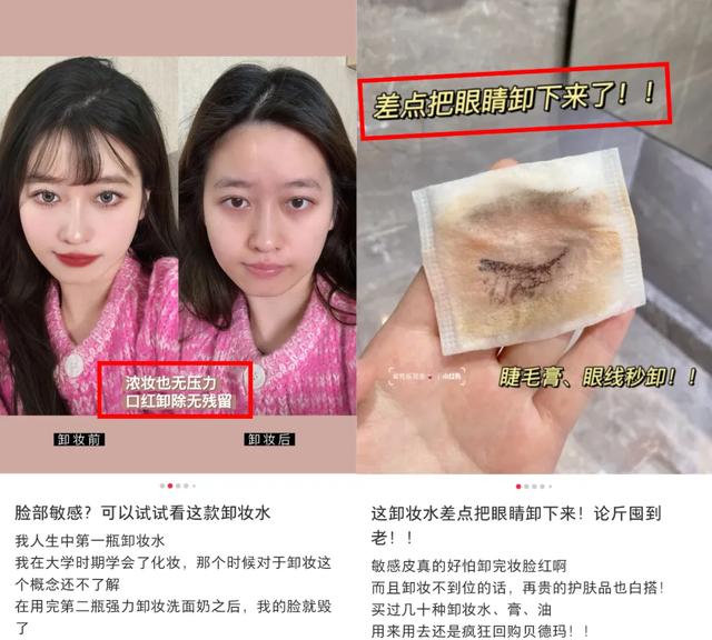 If you don't remove makeup right, you will ruin your face!The correct