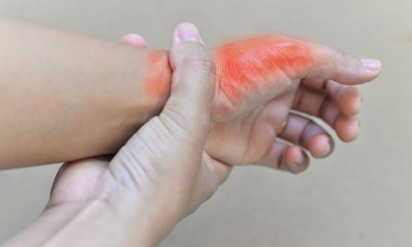 When Uric Acid Is Elevated It Will Cause These 3 Symptoms Do These 4 Things Well And Control 