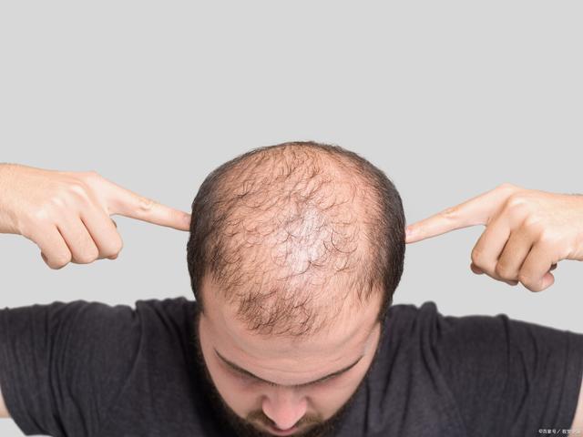 Distinguish these 4 reasons for hair loss, cramps and fatigue, and ...