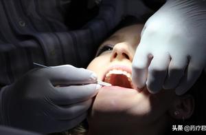 来自牙医的忠告：千万别把智齿一次性拔完，真不是想多收钱