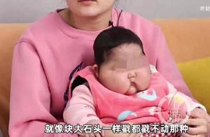 5月婴儿被曝使用“抑菌霜”后变“大头娃娃”，官方介入