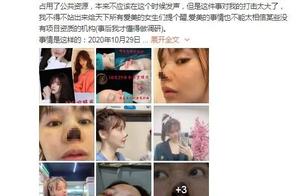 Actress claims nose needle of cure beauty failure is necrotic, how is the person that loves the Unit