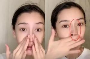 baby直播卸妆「鼻梁诡变S型」 他吓坏：倒抽一口凉气