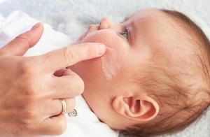 又一宝宝霜检出强效激素！长期用弱、中效激素治湿疹，有危害吗？