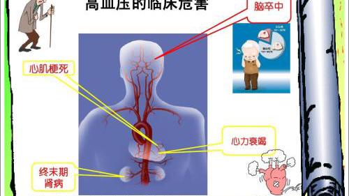 高血压食疗方