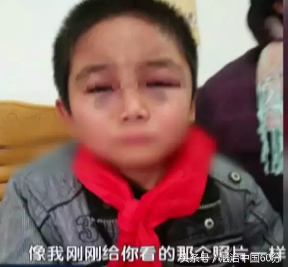 安徽合肥9岁留守男孩在学校被老师殴打致面目全非