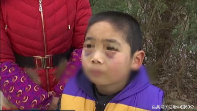 安徽合肥9岁留守男孩在学校被老师殴打致面目全非