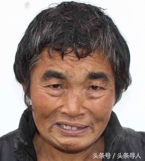 六旬老人在亳州被救助，穿黑色棉衣，自称叫余荣霞，疑似精神障碍