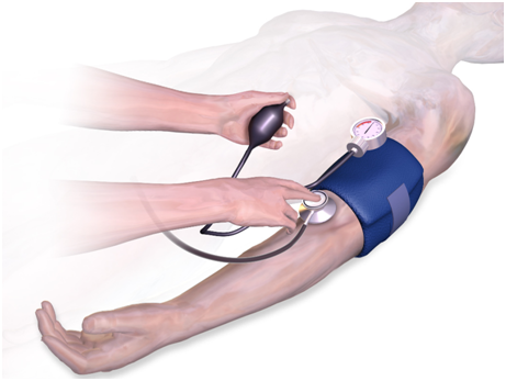 最原始的测血压方法，是一针扎进你的动脉里