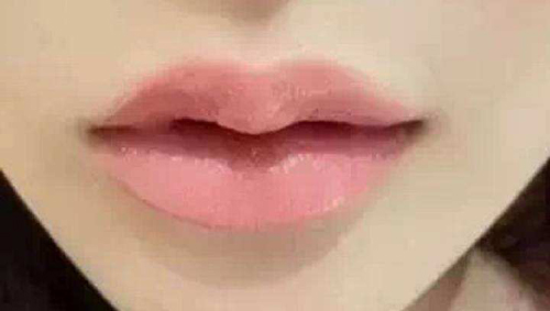 有唇珠的人面相分析 唇珠在面相中代表什么