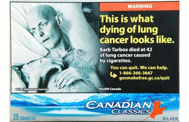 加拿大统计局公布本国最常见的癌症 男女不同